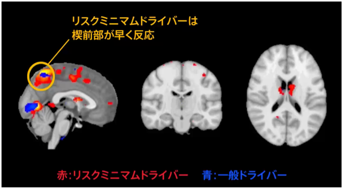 Differences in brain activity between risk-minimizing drivers and regular drivers